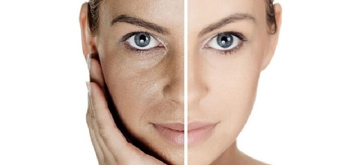 before and after rejuvenation of the facial skin