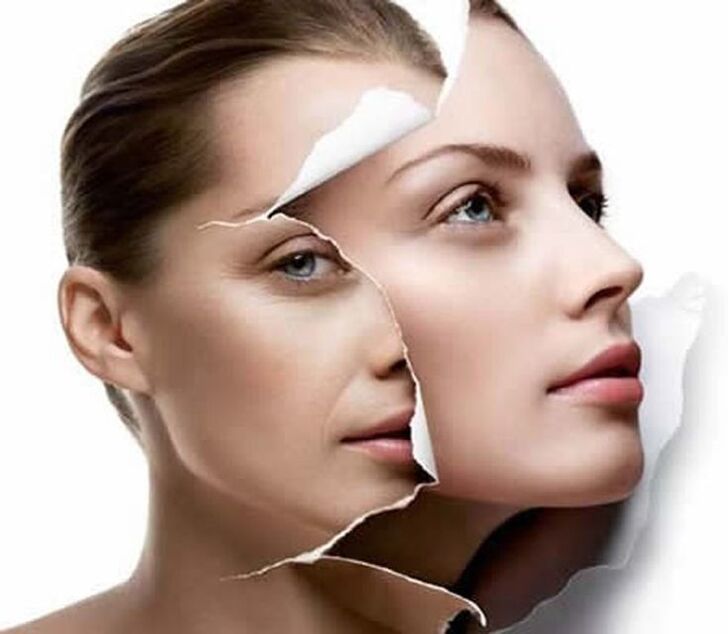 rejuvenation of the facial skin