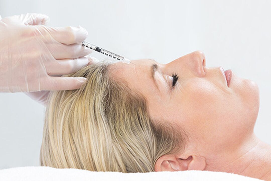 Plasmolifting is an injection method for rejuvenating the facial skin